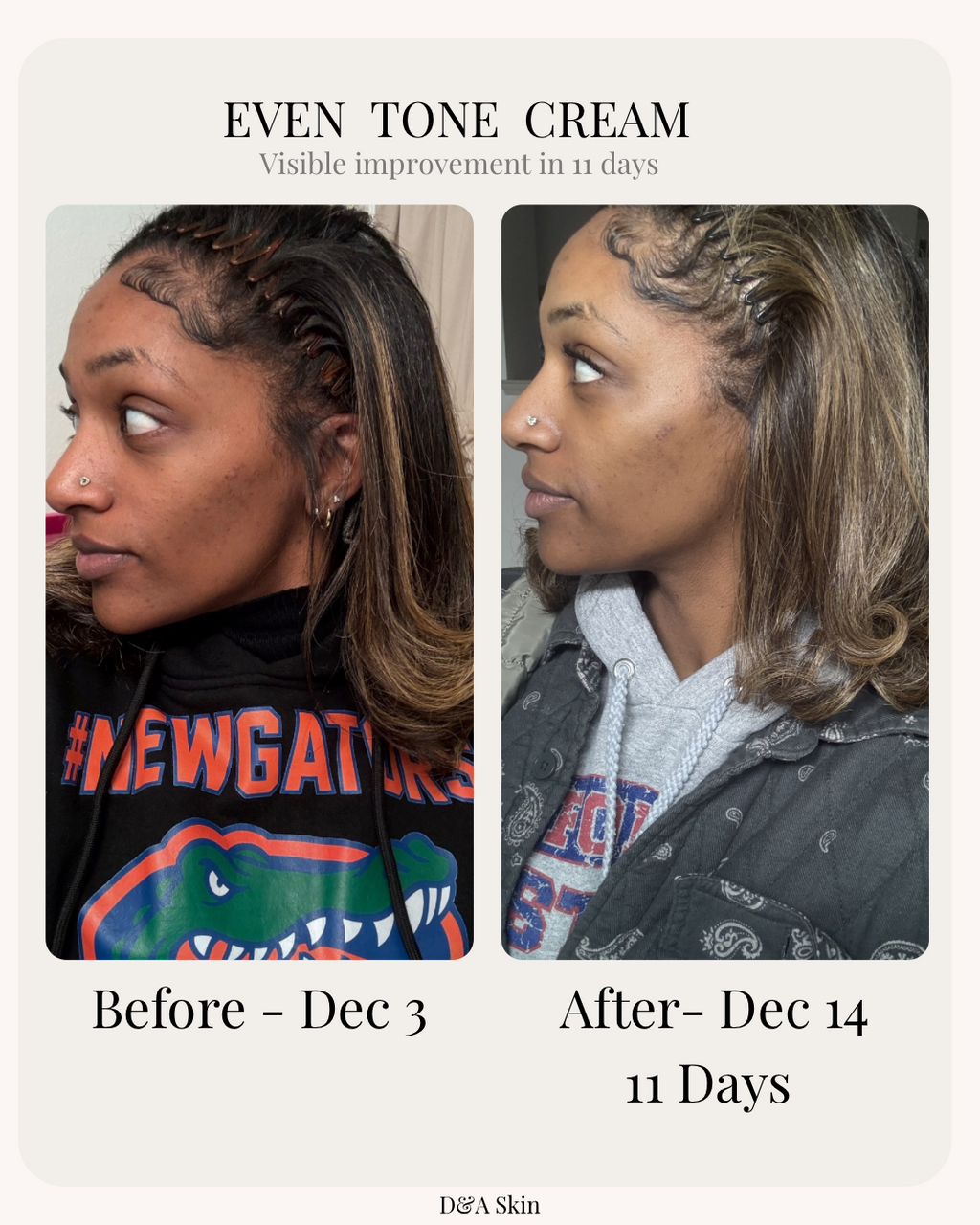 Even Tone Repair Cream