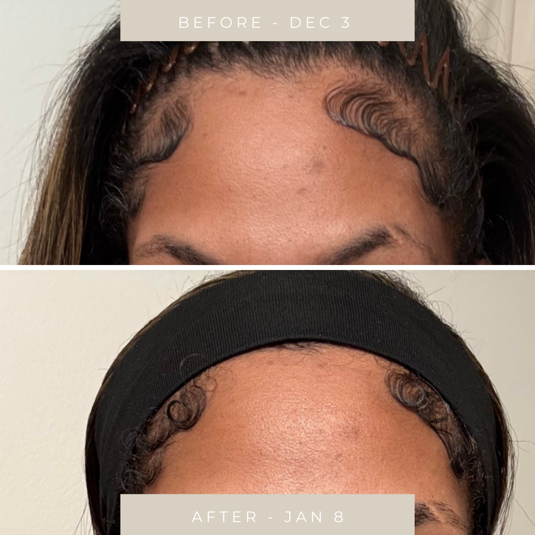 Even Tone Repair Cream